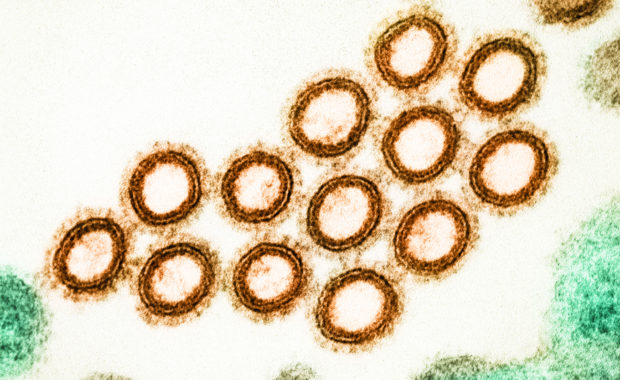 swine flu history