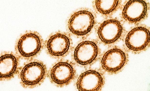 swine flu virus particles